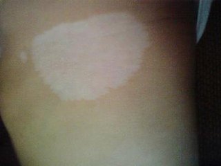 ���ݷ���Ƥ����ҽԺ