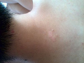 ���ݷ���Ƥ����ҽԺ