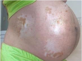 ���ݷ���Ƥ����ҽԺ