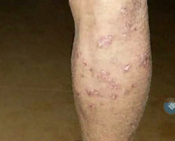 ���ݷ���Ƥ����ҽԺ