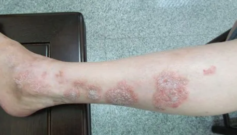 ���ݷ���Ƥ����ҽԺ