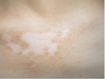 ���ݷ���Ƥ����ҽԺ