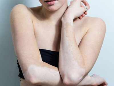 ���ݷ���Ƥ����ҽԺ