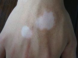 ���ݷ���Ƥ����ҽԺ